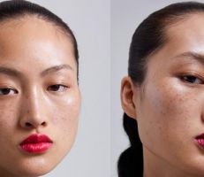حملة لـ"زارا" تشعل الجدل حول النمش ومعايير الجمال في الصين